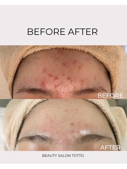 トット 恵比寿(totto)/ケア症例