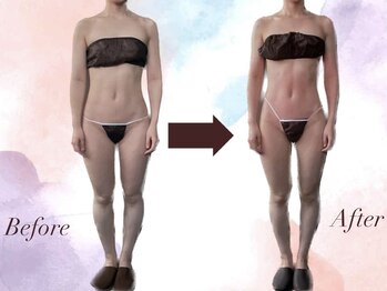 ノエル(NOEL)/ブライダルエステ