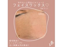 リル(Lill)の雰囲気（フェイスワックスは毛穴を綺麗に！次の日からメイクのノリ抜群♪）