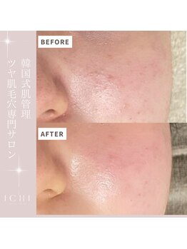 イチ(ichi)/水光肌フェイスワックス