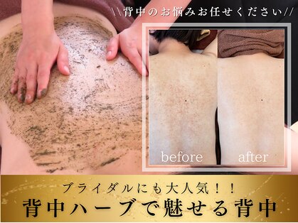 ベレミアム(Bellemium)の写真