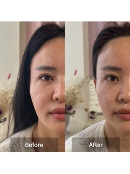 サロン ド アヤ(salon de Aya)/ホルモンバランス×小顔コース