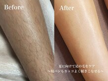 ルルブランシュ(Lulu Blanche)の雰囲気（こだわりのよもぎ！体調メンテナンスまでサポート◎）