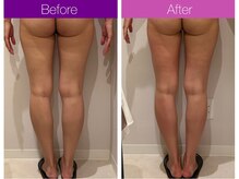 クレヴィア バイ サイバーエステ(CREBIA)/更に上を目指す方にも!