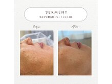 ボーテラボ 大宮(beaute LABO)の雰囲気（セルマン艶玉肌トリートメント【初回¥11,000～】）