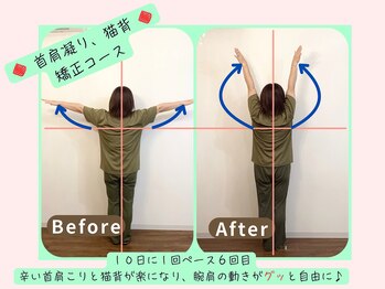 リフィール 国分寺店/Before&After【骨盤/姿勢/整体】