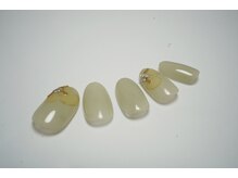 フェリネージュ(Feerieneige)/定額シンプル　8,800円