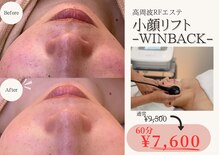 ワイビューティ(Y.Beauty)