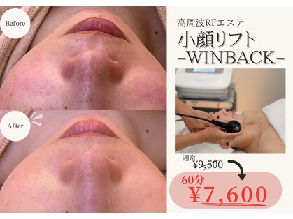 ワイビューティ(Y.Beauty)の写真