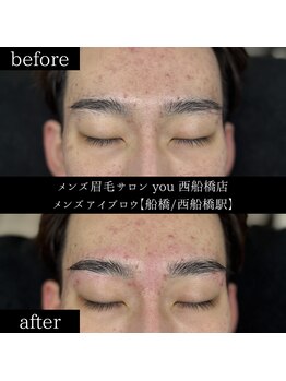 ユー 西船橋店(you)/ビフォーアフターお写真