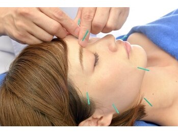 トランク鍼灸院 整骨院 大宮(TRUNK鍼灸院 整骨院)/女性に人気！美容鍼/美顔鍼♪