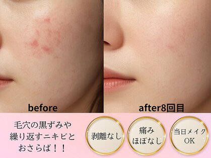 アルバ スキンガーデン(ALBAスキンガーデン)の写真