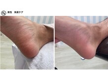ふっとけ庵/足裏角質ケア