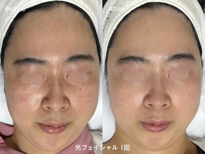 アールビューティー(R Beauty)の写真