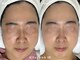 アールビューティー(R Beauty)の写真