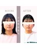 人気No.1【エラ張り・食いしばり・大きさ改善】小顔整体 初回体験