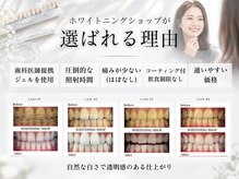 ホワイトニングショップ 土岐店