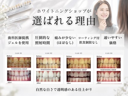 ホワイトニングショップ 土岐店の写真