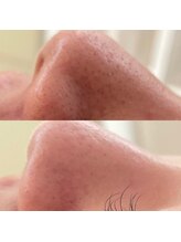 ベリーベリー 九条店(VERY-VERY)/