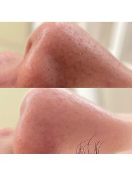 ベリーベリー 九条店(VERY-VERY)/