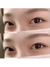 アイリス(eyeris)/まつ毛パーマ