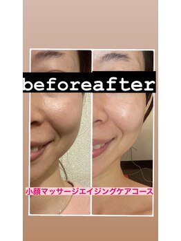 ルルン(LuLuN)/小顔マッサージの効果！！