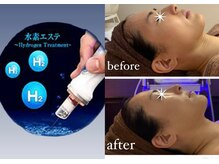 リーチェ ビューティアンドネイルサロン 大名店(Beauty&Nail Salon)の雰囲気（お肌のプロが、お客様に合った施術でキレイを提供します♪）