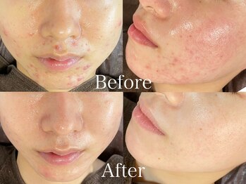 ビースキン 藤沢店(BeSkin)