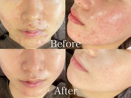 ビースキン 藤沢店(BeSkin)の写真