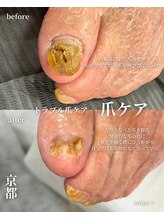 アイル(isle)/【爪が切れないお悩み】のお客様