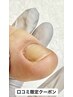 ◆ご新規HPB&Google口コミ割★1,000円OFF ◆ 【陥入爪補正】¥7,470～/ 1箇所