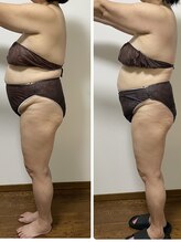 エフハリスト 表参道 外苑前(Efcharisto`)/before after 中間身