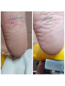 爪切り屋 足楽/