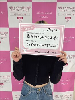 エクシアホワイトニング 秋田大町店/お客様の声