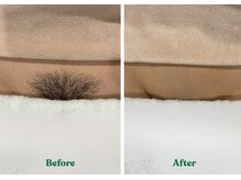 ピュアボディ(Pure Body)