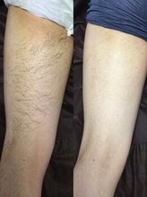 メンズ シンバ(SIMBA)/☆ ビフォーアフター ☆