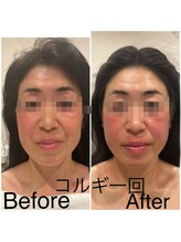 ケイビューティーサロン(K BeautySalon)/リガメント小顔コルギ