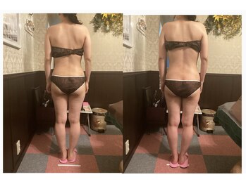 エステティックサロン 凜/筋膜リリース×ラジオ波120分