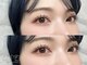 アペル(APPEL)の写真