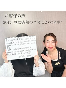 レイ(Rey)/原因不明突然の顎ニキビを改善