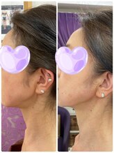 痩身専門サロン ラシュエット(La Chouette)/レモンボトル3回目の結果