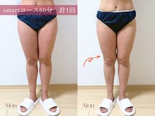 アイオン(Aion)/smartコース60分　1回での変化