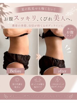 スリラ(SuriLa)の写真/《本気ならココ!》諦めかけていたあなたに!結果を追求した技術☆【全身ハンドデトックス痩身¥9,900】