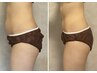 【ウエスト・腰】ポッコリ下腹の脂肪は卒業！つまめないお腹に！