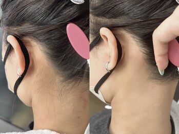 ネリネ 天神(nerine)/うなじワックス♪ワックス脱毛