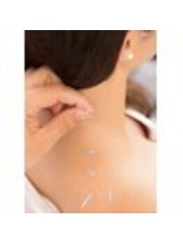 桜琴鍼灸治療院 赤坂店/肩こり、痛い、辛いこと