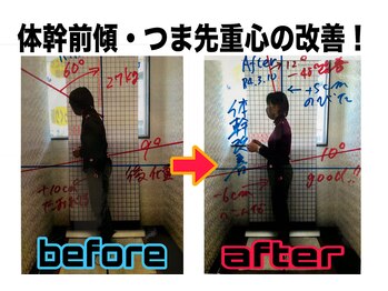 ほねくま接骨院 はりきゅう院 多賀城駅前院/姿勢分析