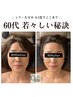 小顔矯正＋美肌美顔器10回コース　通常145,000円→77,000円