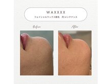 ボーテラボ 大宮(beaute LABO)の雰囲気（フェイシャルワックス脱毛【初回平日¥5,500～】）