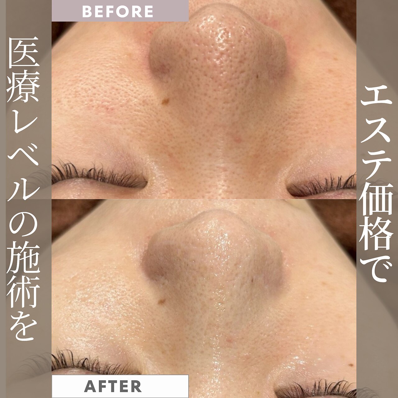 レア(le'a)｜ホットペッパービューティー